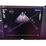 PHiliph EPiQ Series Ultrasound Array Transducer Probe X5-1 XMATRIX