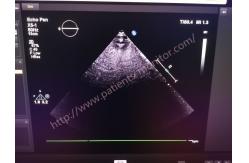 China PHiliph EPiQ Series Ultrasound Array Transducer Probe X5-1 XMATRIX supplier