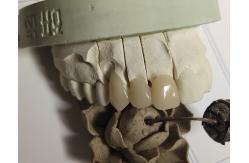 China CAD Technique ISO13485 Interim Crown supplier