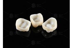 China Natural Full Contour Zirconia Crown Precise Fit Full Contour Dental Lab supplier
