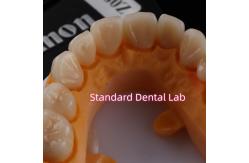 China Dental Strong Layered Zirconia Crowns Full Upper Arch Restoration supplier