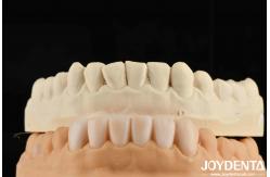 China Lightweight Property Flexible Denture Finish Personalized Customization For Diverse Specifications supplier