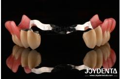 China Framework Setup Teeth Finish Elaborate Technology Beautiful Harmonious Appearance Design supplier