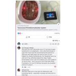 Transcranial Magnetic Stimulation Equipment Treatment Depression RTMS for sale