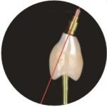 Natural ASC Angled Screw Channel Dental Implants Crown for sale