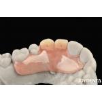 Beautiful And Harmonious Appearance Design Framework Set Up Teeth Finish Elaborate Technology For Stable Oral Structure for sale
