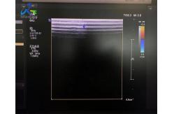 China  L12-3 Linear Array Transducer Probe Ultrasound Crystal And Cable Replacement supplier