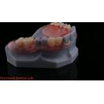 3D Print Model High Esthetics Dental TCS Valplast Flexible Partial Dentures Dental Lab