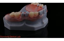 China 3D Print Model High Esthetics Dental TCS Valplast Flexible Partial Dentures Dental Lab supplier