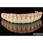 Ti-Bar Zirconia Hybrid Bridge Compatible With Natural Teeth And Gums Autobiography Restoring Chewing Function for sale