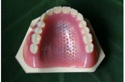 China 3D Printing Metal Skeleton Partial Denture Metal Framework supplier