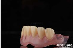 China High Stealth Flexible Removable Denture Finished Comfortable Fit Dental Lab supplier