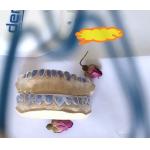 Custom ISO13485 Bleaching Tray For Whitening Teeth for sale