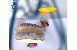 China Custom ISO13485 Bleaching Tray For Whitening Teeth supplier