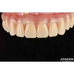 Fast Drying 5 Minutes Acrylic Teeth Finish For Dental Tooth Restoration for sale