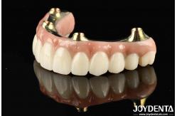 China Functionality Ti-Bar Compatible With Natural Teeth And Gums Restores Chewing Function supplier