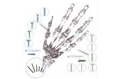 China Orthopedic Implant Bone Fracture Titanium Locking Plate For Hands Foot supplier