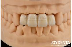China Biologically Oriented Preparation Technique BOPT For Accurate Dental Preparation supplier