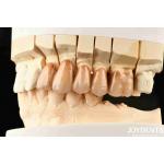 Bionic Development Leaves And Distinct Layers Of Zirconia All-Ceramic for sale