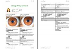 China Latest Digital Iris Analysis Digital Usb Camera Alu Case High Resolusion supplier