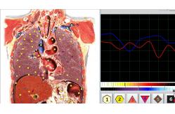 China Body Analyzer Metatron NlS Hunter Version supplier