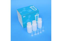 China High Sensitivity 125mL Nucleic Acid Isolation Kit For Virus supplier