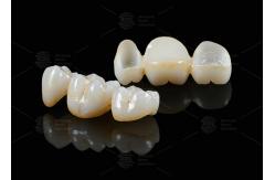 China Translucency White Full Contour Zirconia Crown FCZ Monolithic Zirconia Crown Easy Milling supplier