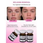 Exosome Injection Melasma Mesotherapy Solution Dermal Fillers Injectable Serum for sale