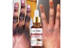 China MSDS Dark Knuckle Whitening Serum Knees And Elbows Glow Dark Knuckle Remover supplier