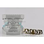 Custom Fitting Sleeping Aid Mouthpieces Dental Appliance To Stop Snoring