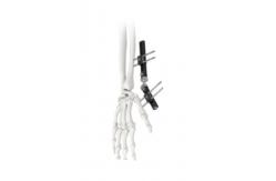 China Orthopedic Wrist External Fixator Standard Single sided Integrated supplier