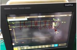 China RESP NIBP SPO2 Intellivue Mx450 Patient Monitor Repair Hospital Use supplier