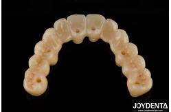 China High Flexibility Zirconia Hybrid Bridge With Titanium Base High Aesthetic supplier