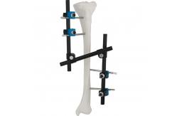 China Condylar External Fixation Device supplier