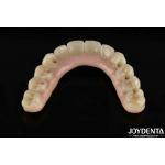 High Durability Zirconia  Ultimate Solution For Natural Teeth And Gums Compatibility