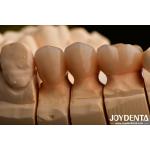 High Chipping Resistance And Natural-looking Esthetics With Multilayer Full Zirconia Technology