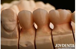 China High Chipping Resistance And Natural-looking Esthetics With Multilayer Full Zirconia Technology supplier