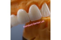 China CAD CAM Mill Zirconia Crown Bridge Highly Biocompatible supplier