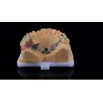 Partial Cobalt Chrome Dentures Ivoclar Scheftner Comfortable Metal Framework Delivered in Just 3 Days for sale