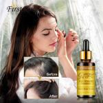 Lanthome Ginger Hair Growth Essence 7 Days