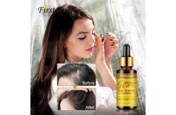 China Lanthome Ginger Hair Growth Essence 7 Days supplier