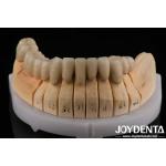 Gold Alloy PFM Porcelain Fused to Metal Dental Compatible With Porcelain Layering for sale