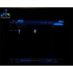 Cardiac Ultrasound Transducer Phased Probe Biosound Biosound PA230E for sale