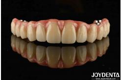 China Adjustable Titanium Malong Hybrid Bridge Perfect Combination Of Traditional And Modern Techniques supplier