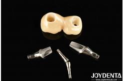 China Experience Aesthetically Pleasing Results With Customizable Implant Retained Crown And Bridge supplier
