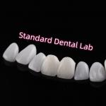 Abrasion Resistant Emax Zirconia Laminate Veneers Incisal Translucency for sale