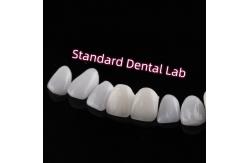 China Abrasion Resistant Emax Zirconia Laminate Veneers Incisal Translucency supplier