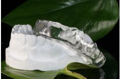 China Custom Made Mandibular Arch Stablizing Bite Splint supplier