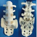 Medical practice teaching with bone training with bone simulation lumbar vertebrae with sacral lumbar 3 to sacral simula for sale