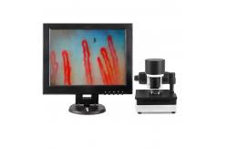 China Blood Capillary Microcirculation Microscope 600X Magnification DC12V 2A Output supplier